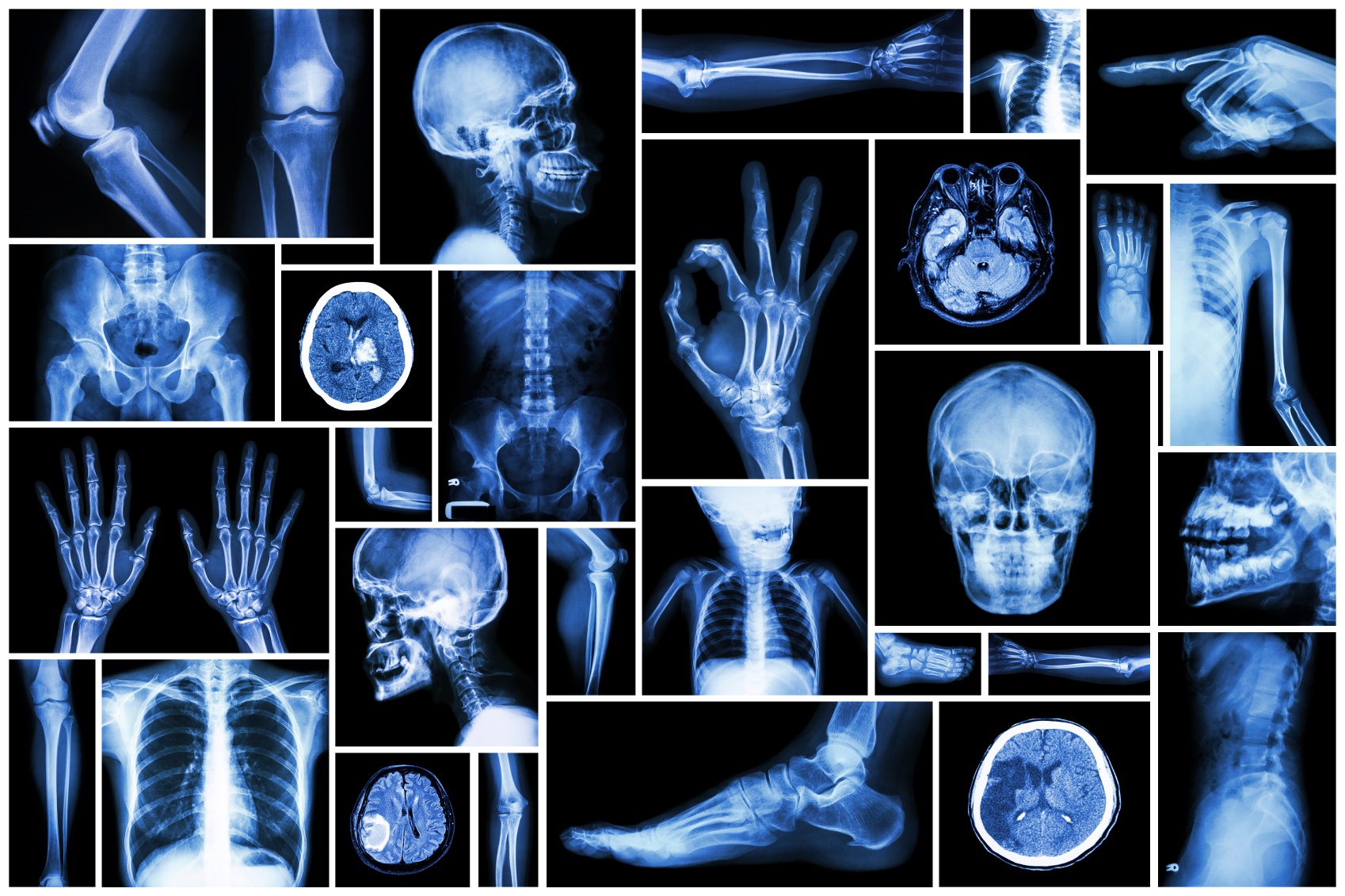 x-ray-scans-of-different-body-parts x-ray-scans-of-different-body-parts